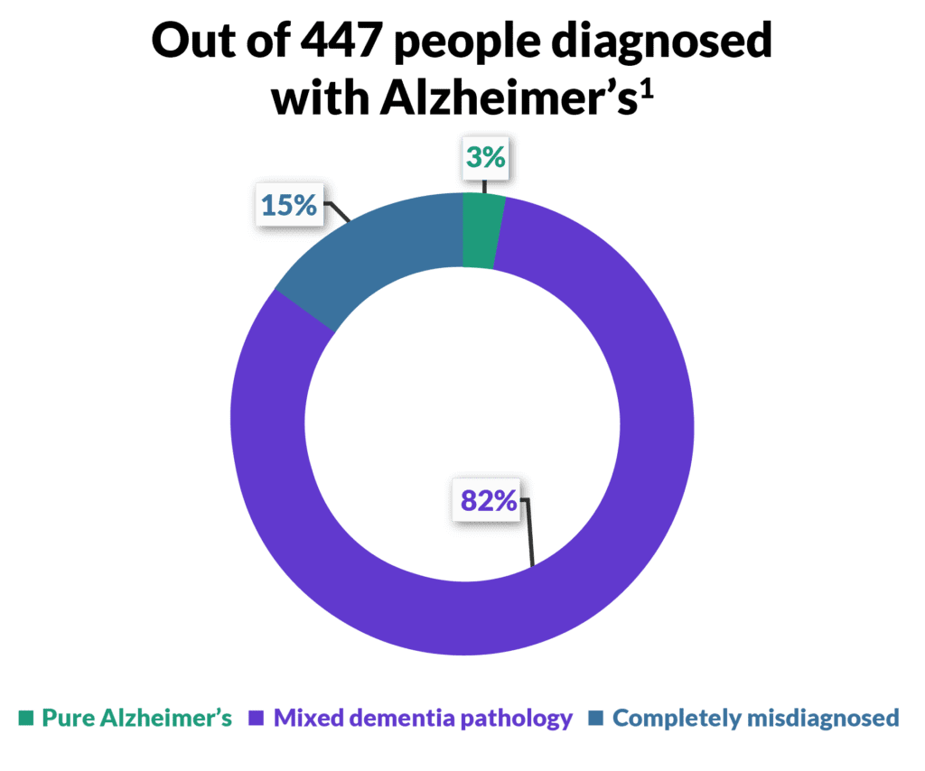 Alzheimer's disease diagram