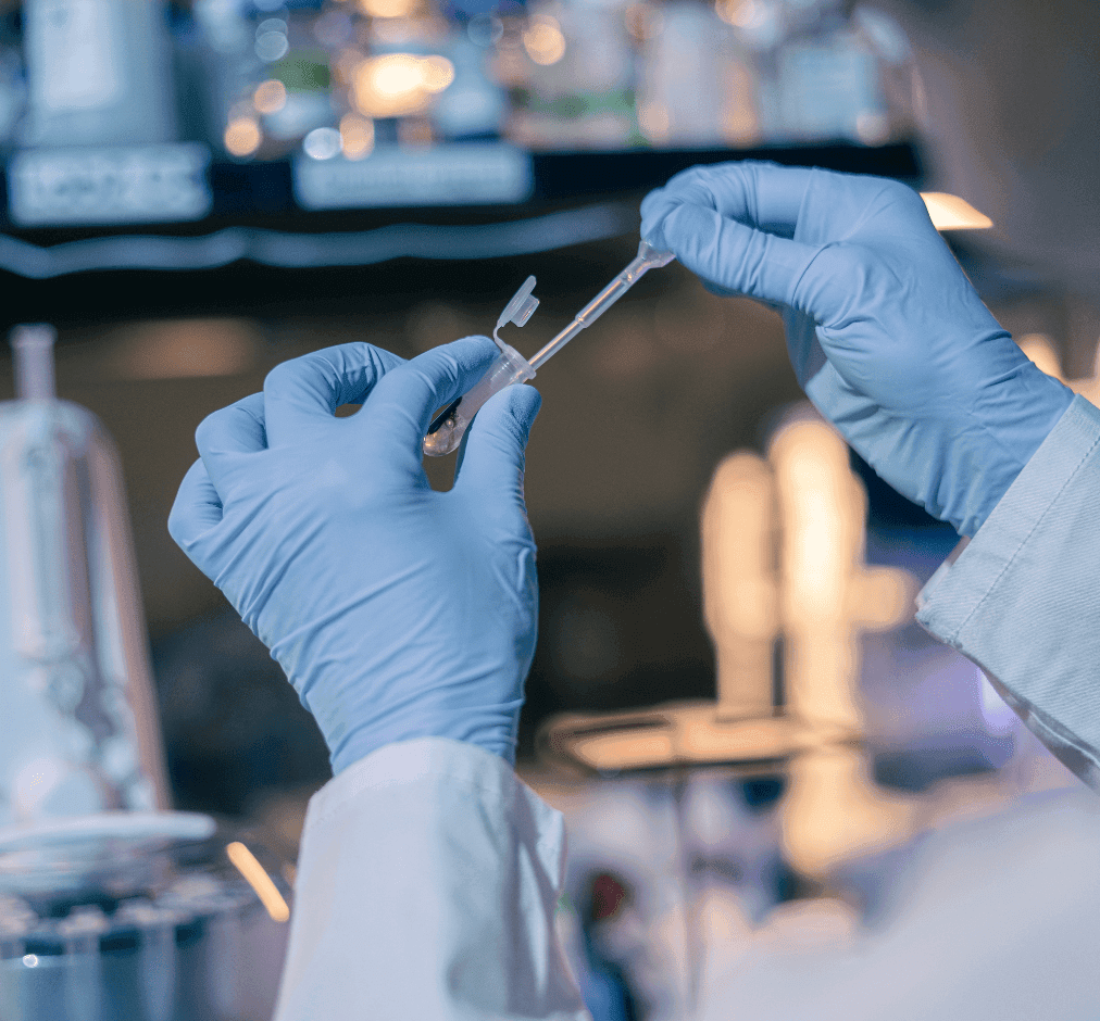 Alpha synuclein antibody