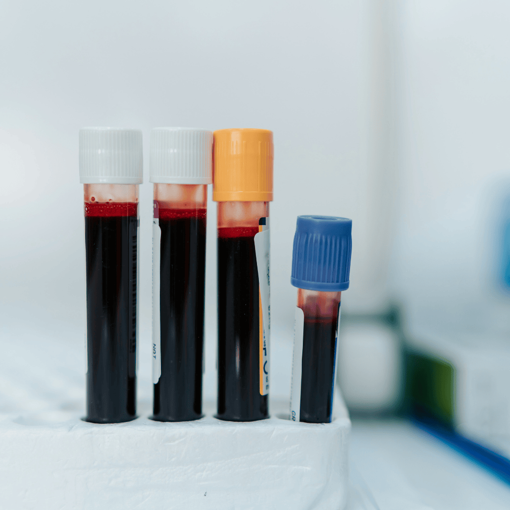 The Promise of Early Detection and Precision: Why Biomarkers Matter Now