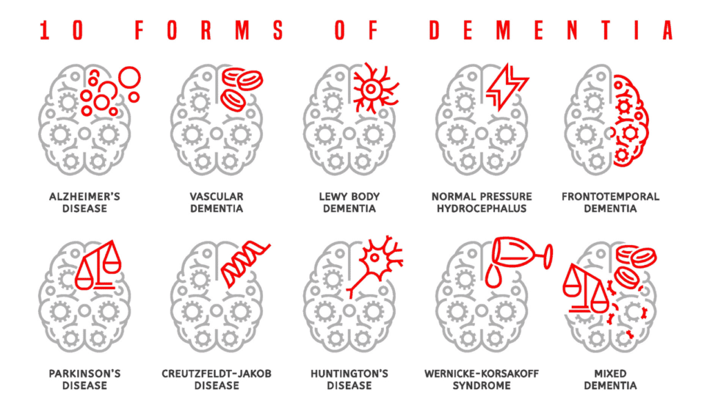 10 Kinds of Dementia