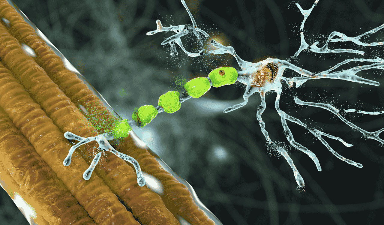 Amyotrophic Lateral Sclerosis (ALS)