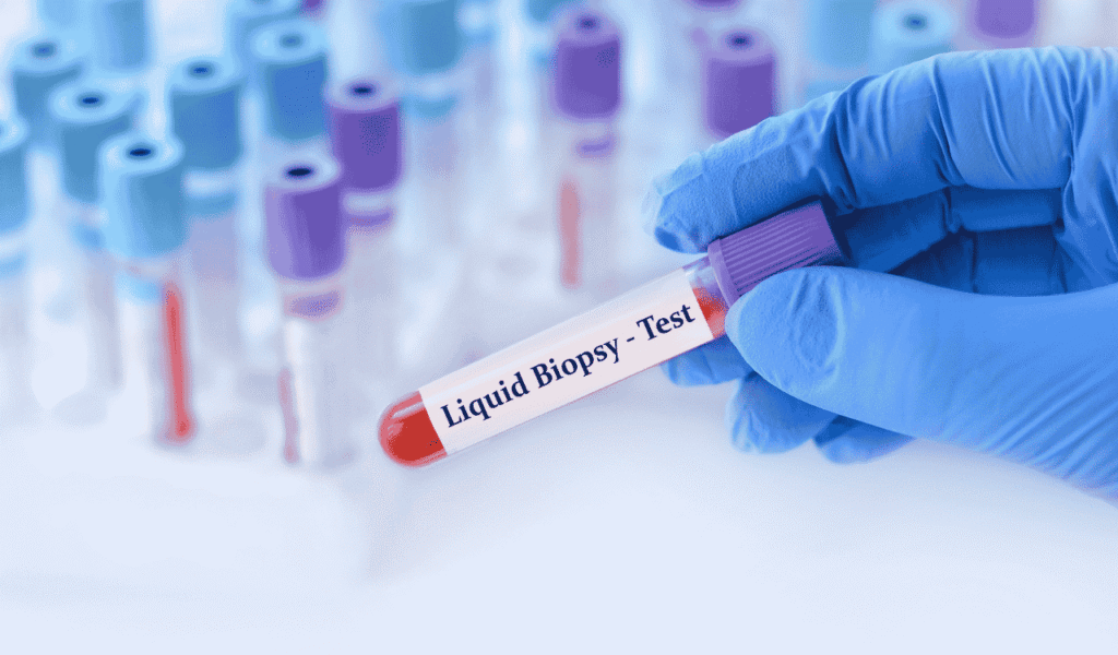 Liquid Biopsy for Neurodegenerative Diseases
