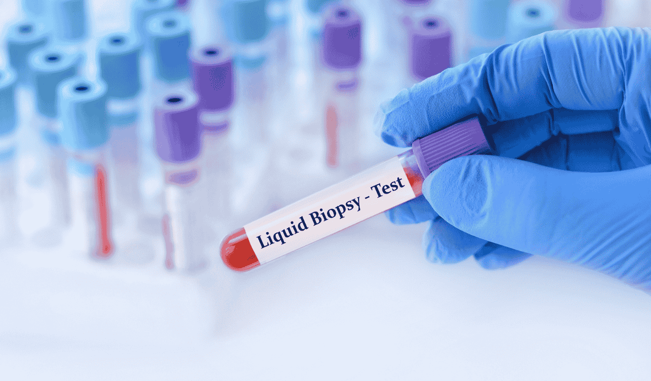 Liquid Biopsy for Neurodegenerative Diseases