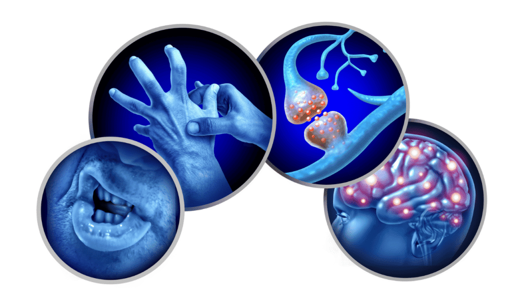 Multiple System Atrophy