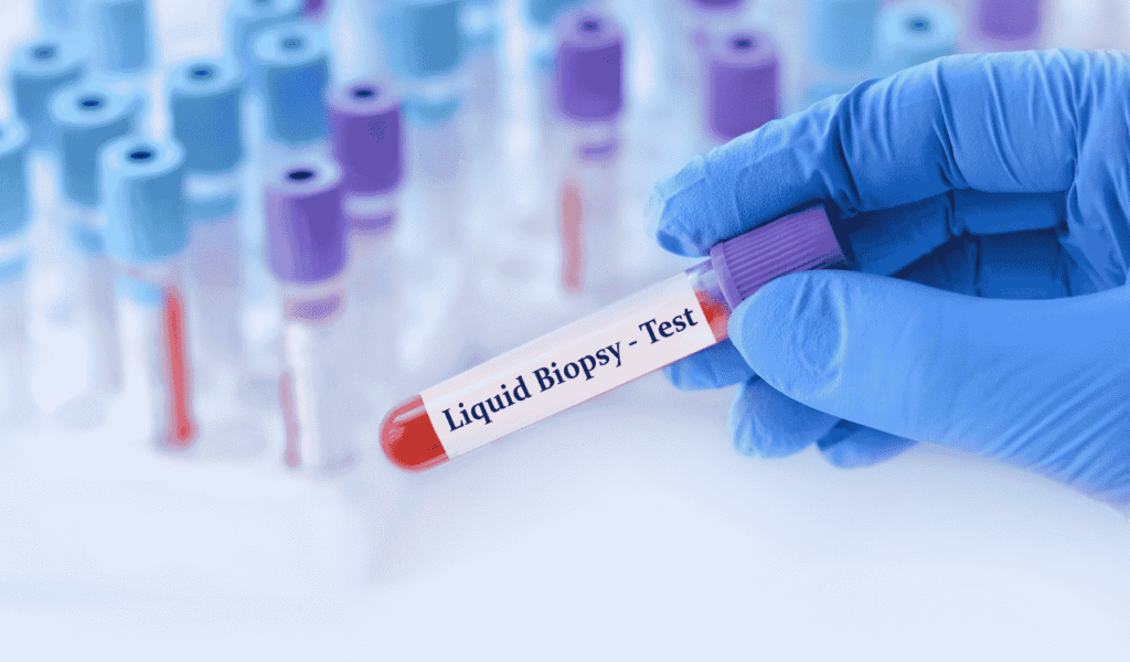 Liquid Biopsy for Neurological Diseases: How It Works