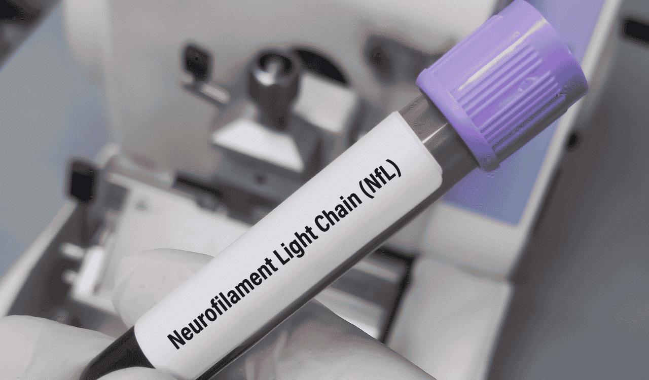 ELLA™ Neurofilament Light Chain (NF-L) Immunoassay