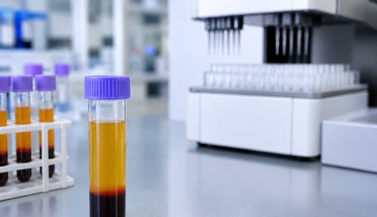 Laboratory plasma sample representing blood-based TDP-43 biomarker analysis for neuron-derived extracellular vesicle (NDEV) target engagement studies in neurodegenerative disease drug development.