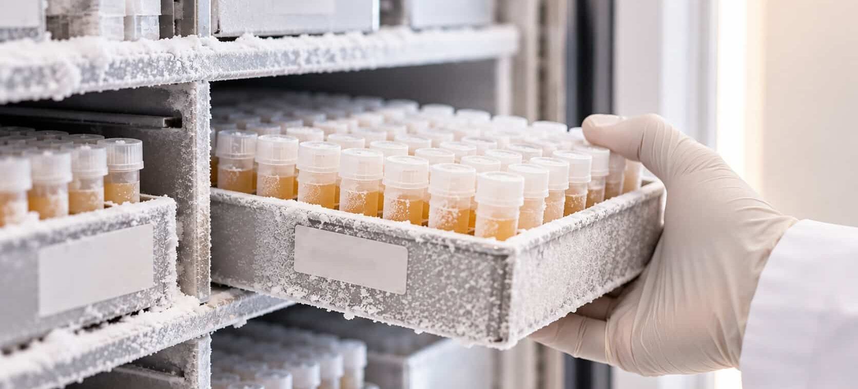 Banked plasma samples stored in a biorepository freezer for a blood biomarker feasibility study